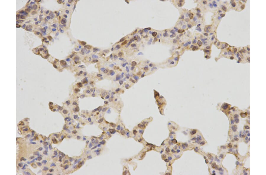 Immunohistochemistry - TNF-R1 Antibody from Signalway Antibody (32304) - Antibodies.com