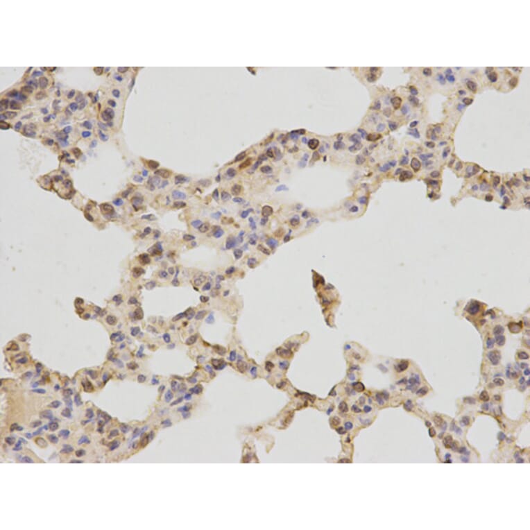 Immunohistochemistry - TNF-R1 Antibody from Signalway Antibody (32304) - Antibodies.com