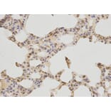Immunohistochemistry - TNF-R1 Antibody from Signalway Antibody (32304) - Antibodies.com