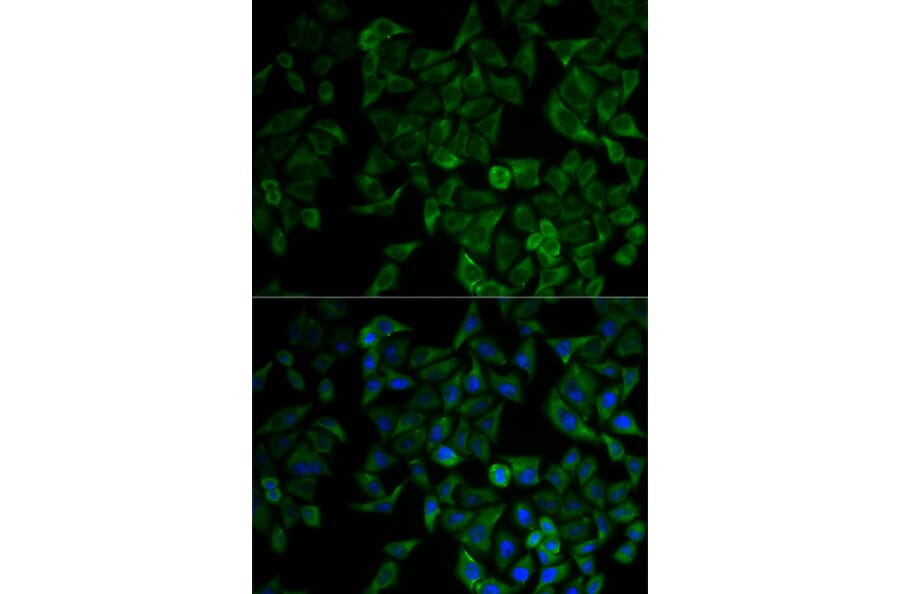 Immunofluorescence - TNF-R1 Antibody from Signalway Antibody (32304) - Antibodies.com
