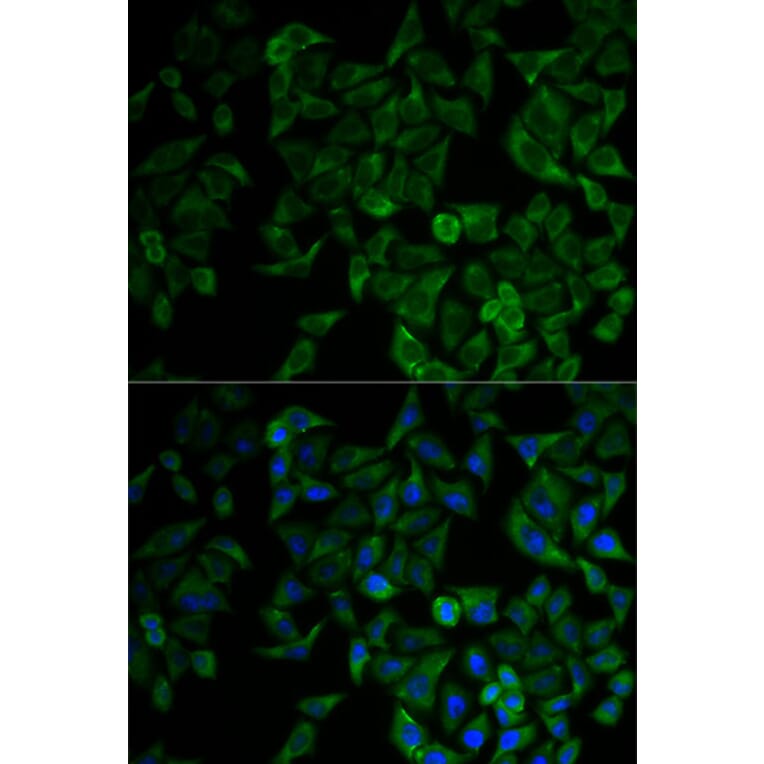 Immunofluorescence - TNF-R1 Antibody from Signalway Antibody (32304) - Antibodies.com