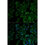 Immunofluorescence - TNF-R1 Antibody from Signalway Antibody (32304) - Antibodies.com