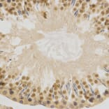 Immunohistochemistry - ELAVL1 Antibody from Signalway Antibody (32337) - Antibodies.com