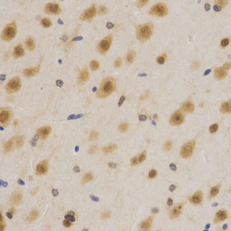 Immunohistochemistry - ELAVL1 Antibody from Signalway Antibody (32337) - Antibodies.com