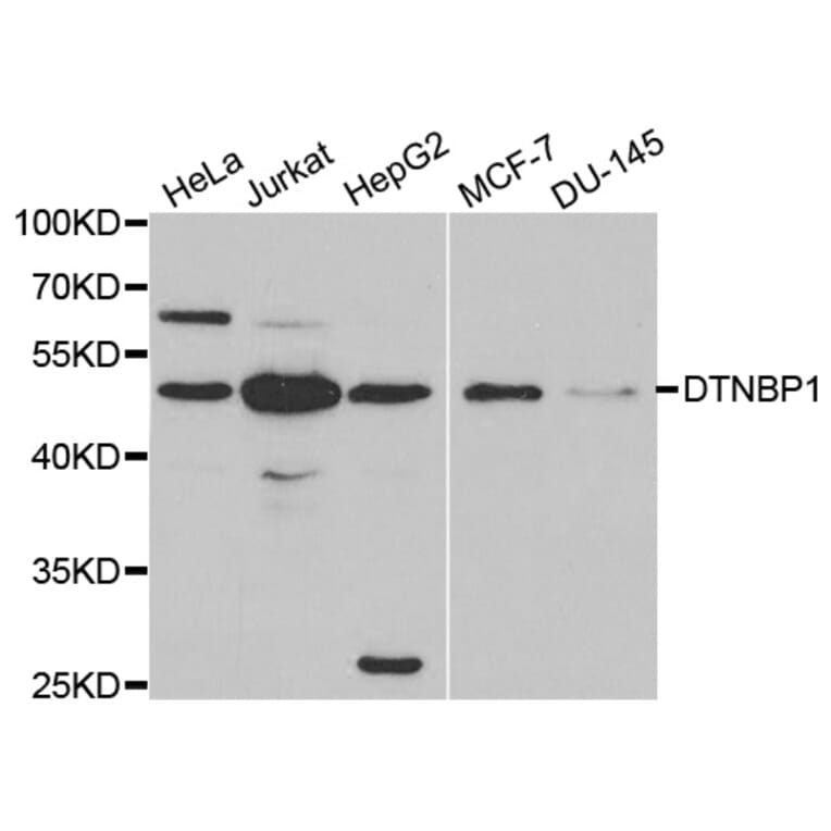 Western blot - DTNBP1 Antibody from Signalway Antibody (32355) - Antibodies.com
