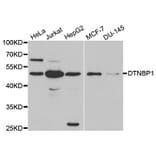 Western blot - DTNBP1 Antibody from Signalway Antibody (32355) - Antibodies.com