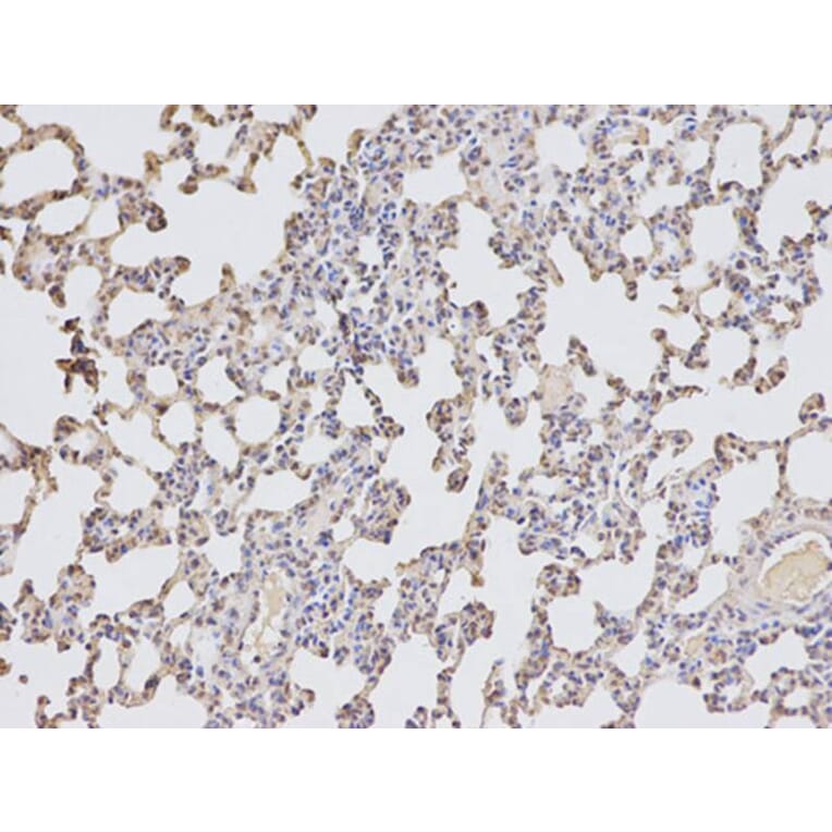 Immunohistochemistry - DTNBP1 Antibody from Signalway Antibody (32355) - Antibodies.com