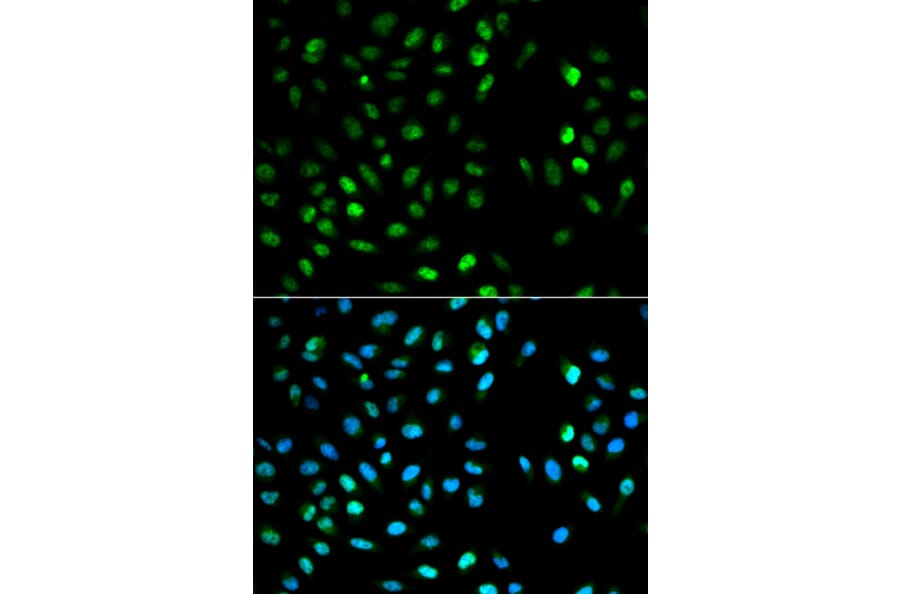 Immunofluorescence - DTNBP1 Antibody from Signalway Antibody (32355) - Antibodies.com