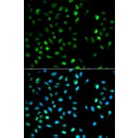 Immunofluorescence - DTNBP1 Antibody from Signalway Antibody (32355) - Antibodies.com