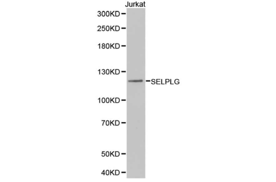 Western blot - SELPLG Antibody from Signalway Antibody (32371) - Antibodies.com