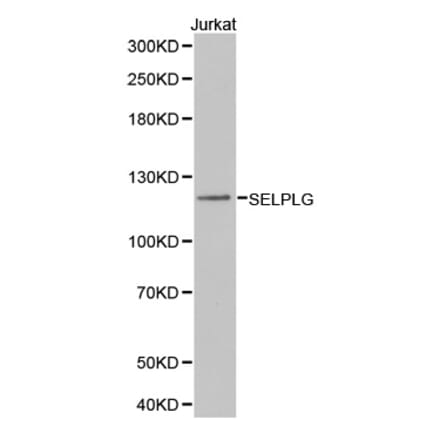 Western blot - SELPLG Antibody from Signalway Antibody (32371) - Antibodies.com