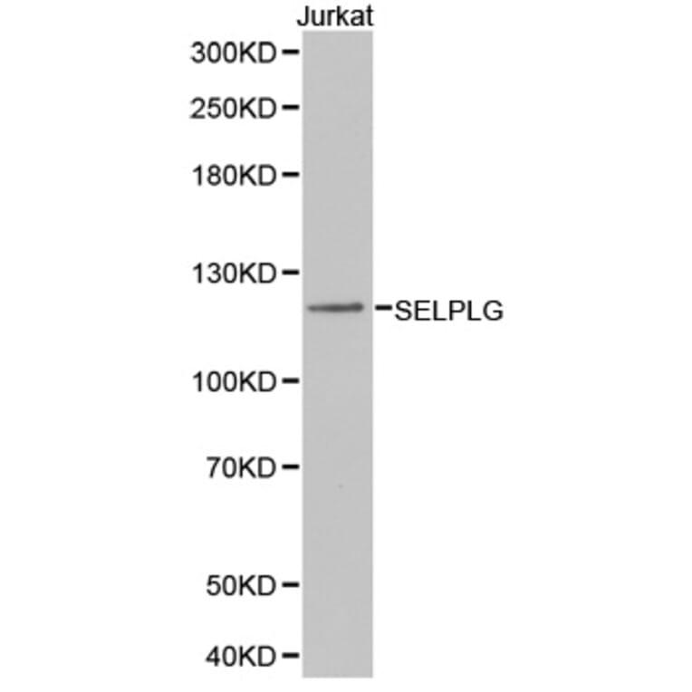 Western blot - SELPLG Antibody from Signalway Antibody (32371) - Antibodies.com