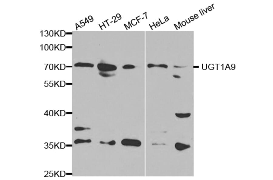 Western blot - UGT1A9 Antibody from Signalway Antibody (32372) - Antibodies.com