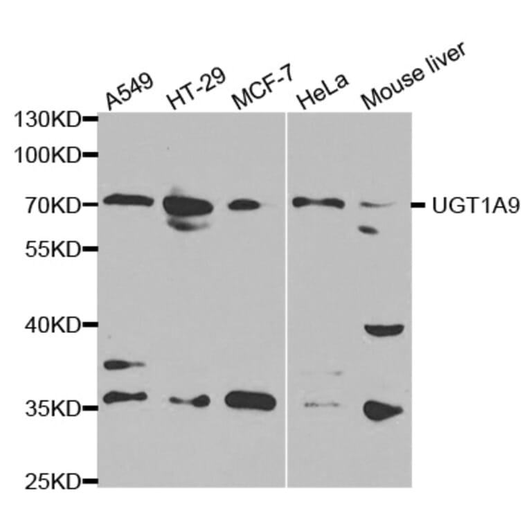 Western blot - UGT1A9 Antibody from Signalway Antibody (32372) - Antibodies.com