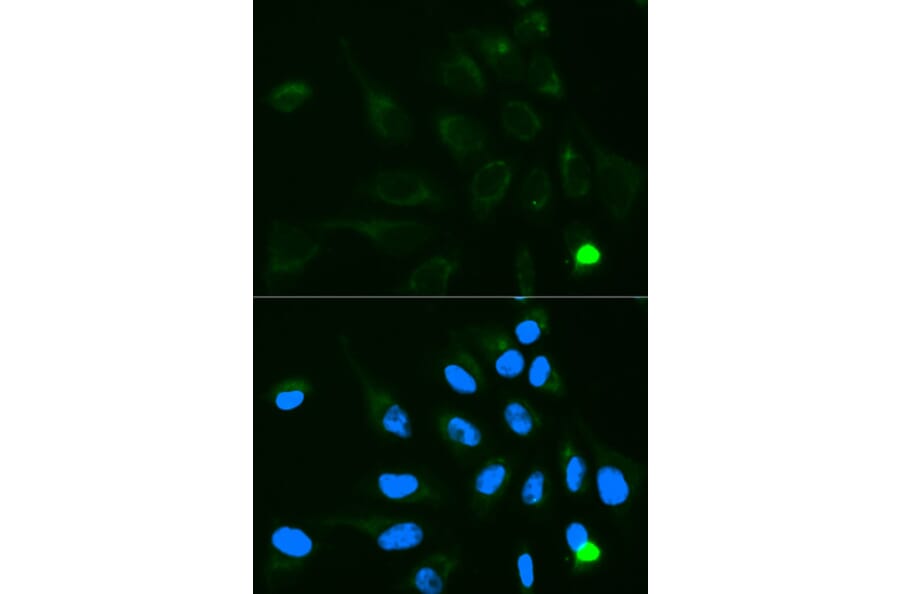Immunofluorescence - UGT1A9 Antibody from Signalway Antibody (32372) - Antibodies.com