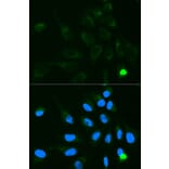 Immunofluorescence - UGT1A9 Antibody from Signalway Antibody (32372) - Antibodies.com