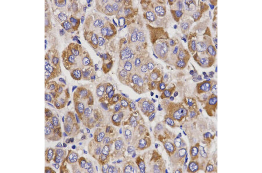 Immunohistochemistry - UGT1A9 Antibody from Signalway Antibody (32372) - Antibodies.com