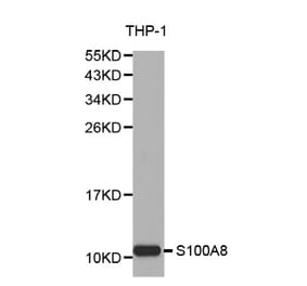 Western blot - S100A8 Antibody from Signalway Antibody (32387) - Antibodies.com