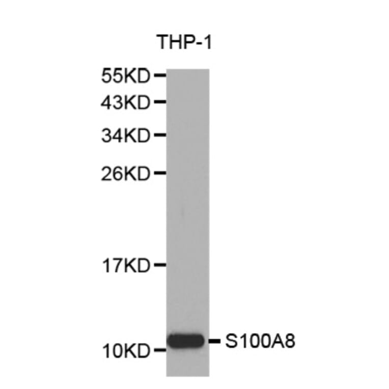 Western blot - S100A8 Antibody from Signalway Antibody (32387) - Antibodies.com