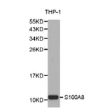 Western blot - S100A8 Antibody from Signalway Antibody (32387) - Antibodies.com