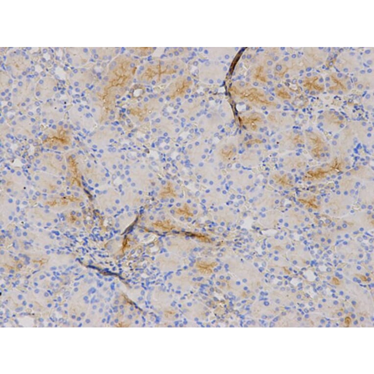 Immunohistochemistry - S100A8 Antibody from Signalway Antibody (32387) - Antibodies.com