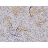 Immunohistochemistry - S100A8 Antibody from Signalway Antibody (32387) - Antibodies.com