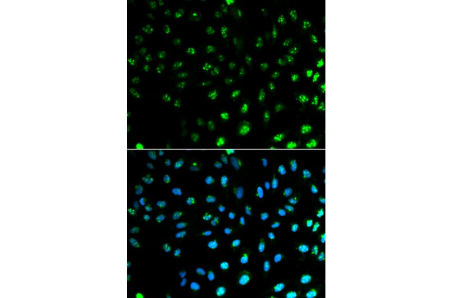 Immunofluorescence - S100A8 Antibody from Signalway Antibody (32387) - Antibodies.com
