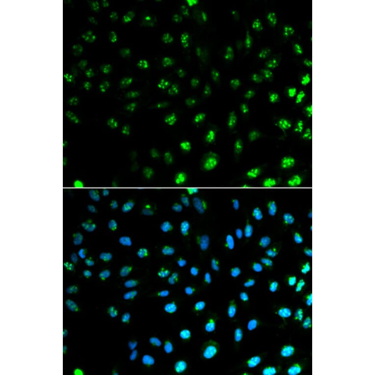 Immunofluorescence - S100A8 Antibody from Signalway Antibody (32387) - Antibodies.com