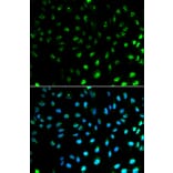 Immunofluorescence - S100A8 Antibody from Signalway Antibody (32387) - Antibodies.com