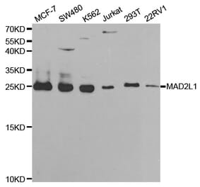 Western blot - MAD2L1 Antibody from Signalway Antibody (32392) - Antibodies.com