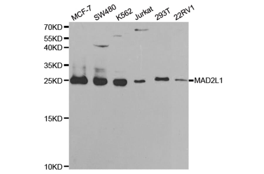 Western blot - MAD2L1 Antibody from Signalway Antibody (32392) - Antibodies.com