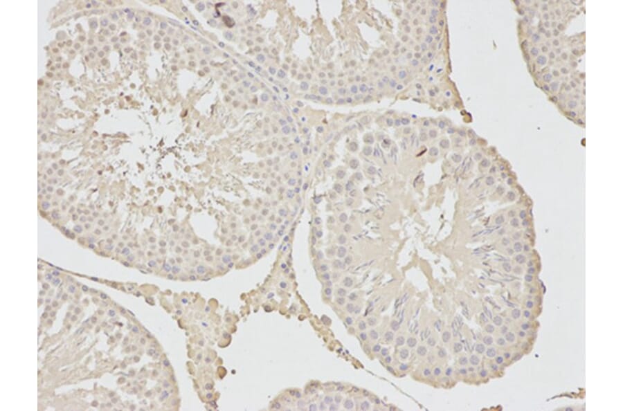 Immunohistochemistry - MAD2L1 Antibody from Signalway Antibody (32392) - Antibodies.com