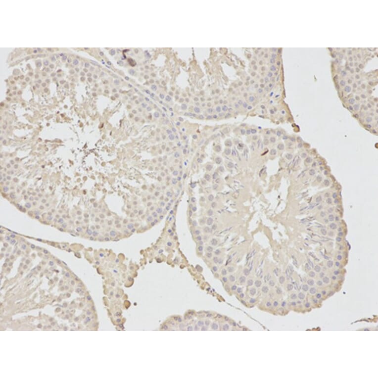 Immunohistochemistry - MAD2L1 Antibody from Signalway Antibody (32392) - Antibodies.com