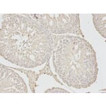 Immunohistochemistry - MAD2L1 Antibody from Signalway Antibody (32392) - Antibodies.com