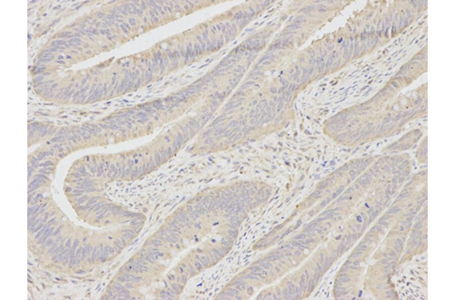 Immunohistochemistry - MAD2L1 Antibody from Signalway Antibody (32392) - Antibodies.com