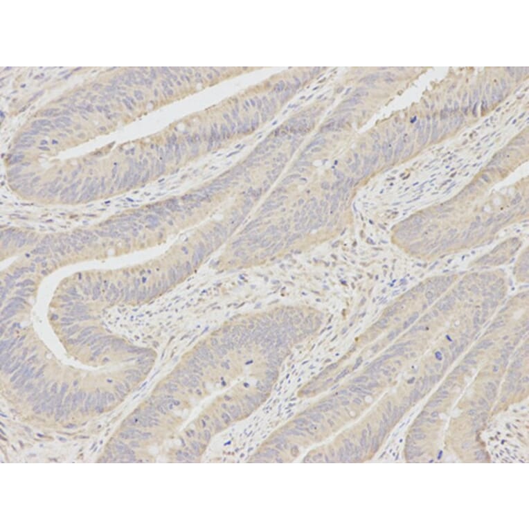 Immunohistochemistry - MAD2L1 Antibody from Signalway Antibody (32392) - Antibodies.com