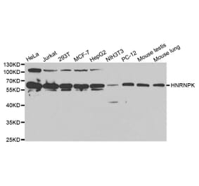 Western blot - HNRNPK Antibody from Signalway Antibody (32393) - Antibodies.com