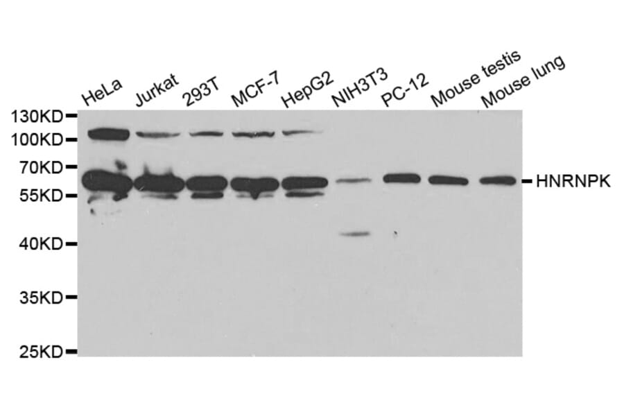 Western blot - HNRNPK Antibody from Signalway Antibody (32393) - Antibodies.com