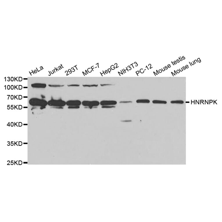 Western blot - HNRNPK Antibody from Signalway Antibody (32393) - Antibodies.com