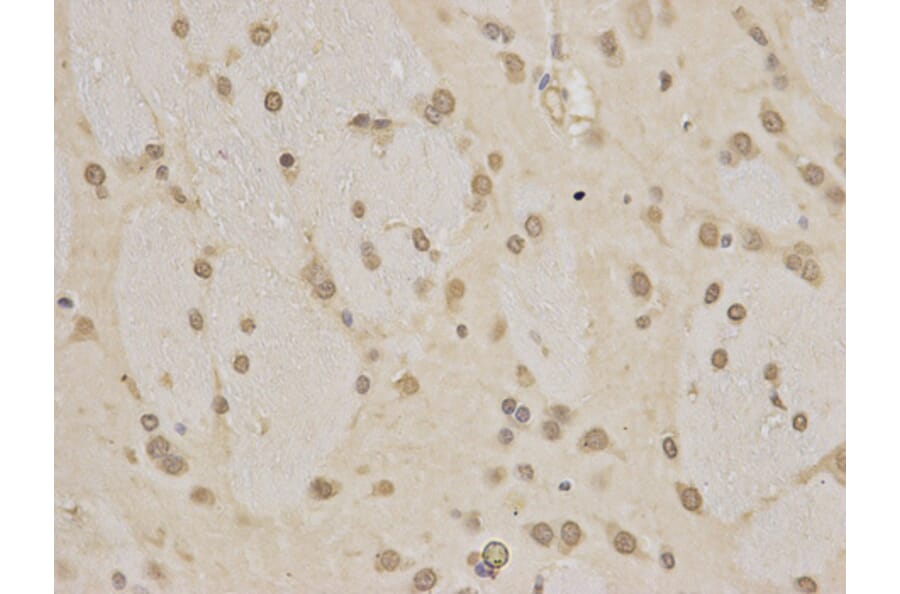 Immunohistochemistry - HNRNPK Antibody from Signalway Antibody (32393) - Antibodies.com