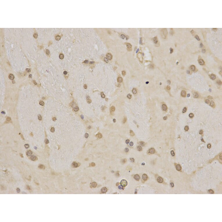 Immunohistochemistry - HNRNPK Antibody from Signalway Antibody (32393) - Antibodies.com