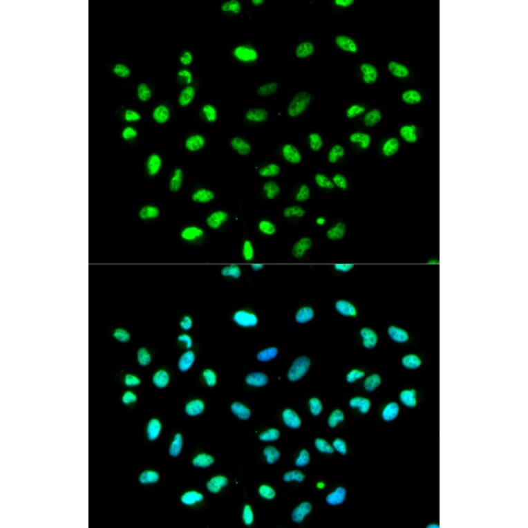 Immunofluorescence - HNRNPK Antibody from Signalway Antibody (32393) - Antibodies.com