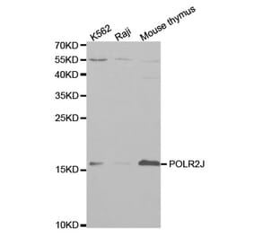 Western blot - POLR2J Antibody from Signalway Antibody (32464) - Antibodies.com