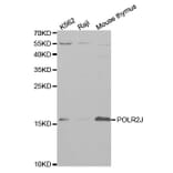 Western blot - POLR2J Antibody from Signalway Antibody (32464) - Antibodies.com