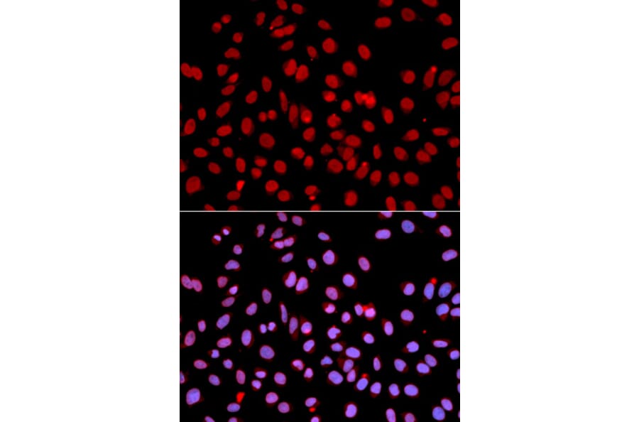 Immunofluorescence - POLR2J Antibody from Signalway Antibody (32464) - Antibodies.com