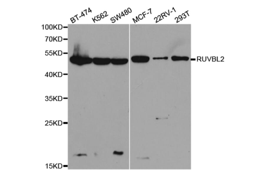 Western blot - RUVBL2 Antibody from Signalway Antibody (32492) - Antibodies.com