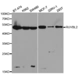 Western blot - RUVBL2 Antibody from Signalway Antibody (32492) - Antibodies.com