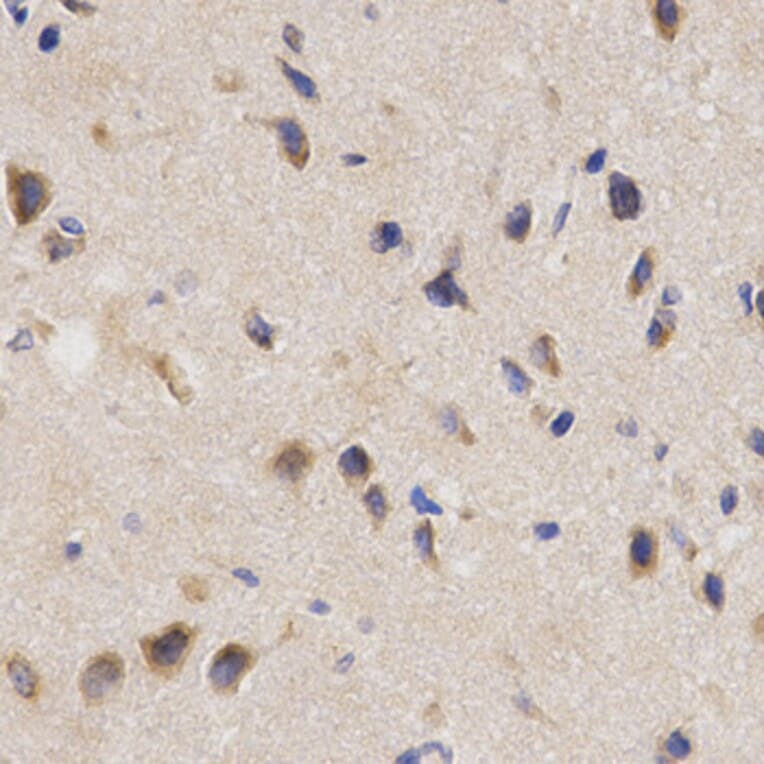 Immunohistochemistry - PPP2R4 Antibody from Signalway Antibody (32495) - Antibodies.com