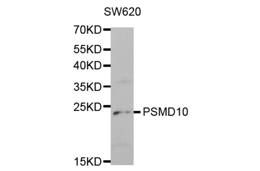 Western blot - PSMD10 Antibody from Signalway Antibody (32516) - Antibodies.com