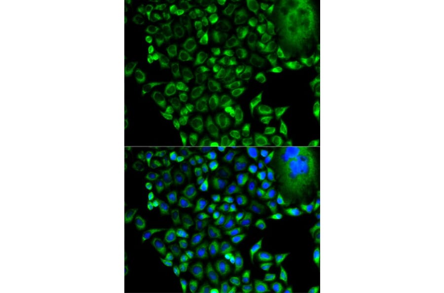 Immunofluorescence - PSMD10 Antibody from Signalway Antibody (32516) - Antibodies.com